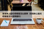 宝宝身上起红疙瘩是怎么回事(宝宝身上起红疙瘩是怎么回事图片) 宝宝身上起红疙瘩是怎么回事(宝宝身上起红疙瘩是怎么回事图片)